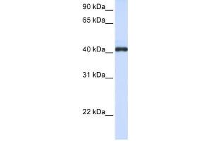 FCRLA antibody used at 1 ug/ml to detect target protein. (FCRLA 抗体  (C-Term))