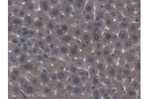 DAB staining on IHC-P; Samples: Mouse Liver Tissue (ACP6 抗体  (AA 1-418))