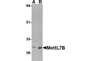 Western Blotting (WB) image for anti-Methyltransferase Like 7B (METTL7B) (C-Term) antibody (ABIN1030517) (METTL7B 抗体  (C-Term))