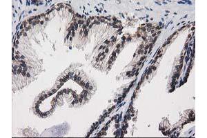 Image no. 2 for anti-Protein Kinase C, epsilon (PRKCE) antibody (ABIN1500228) (PKC epsilon 抗体)