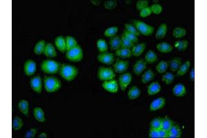 Immunofluorescent analysis of A549 cells using ABIN7163557 at dilution of 1:100 and Alexa Fluor 488-congugated AffiniPure Goat Anti-Rabbit IgG(H+L) (LCP1 抗体  (AA 2-627))