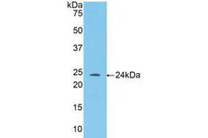 Western blot analysis of recombinant Mouse ANGPT1. (Angiopoietin 1 抗体  (AA 35-231))