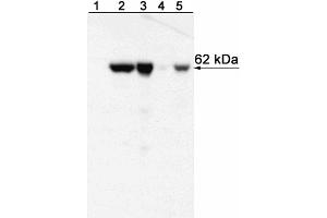 Western blot analysis of T-bet expressed by Mouse Th1 and Th2 cells and Human NK cell and T cell leukemia lines and Peripheral Blood Mononuclear Cells (PBMC). (T-Bet 抗体)