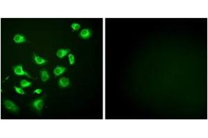 Immunofluorescence analysis of HepG2 cells, using GRP94 Antibody. (GRP94 抗体  (AA 754-803))