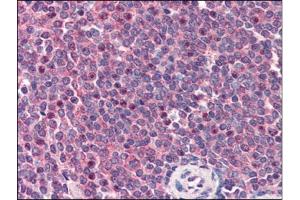 Human Spleen (formalin-fixed, paraffin-embedded) stained with CARD11at 2 µg/ml followed by biotinylated anti-goat IgG secondary antibody, alkaline phosphatase-streptavidin and chromogen. (CARD11 抗体  (C-Term))