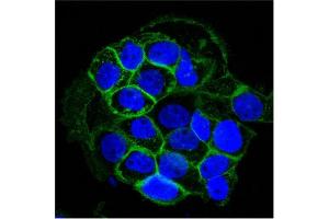 Confocal Immunofluorescent analysis of A431 cells using AF488-labeled EGFR Monoclonal Antibody (GFR450) (Green).