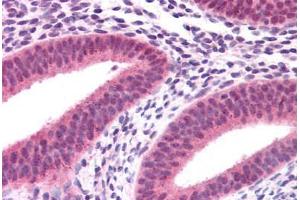 Human Uterus: Formalin-Fixed, Paraffin-Embedded (FFPE) (K-RAS 抗体  (N-Term))