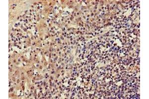 Immunohistochemistry of paraffin-embedded human tonsil tissue using ABIN7165618 at dilution of 1:100 (C22orf13 抗体  (AA 1-136))