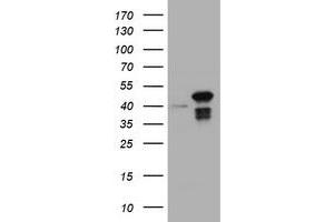 Image no. 1 for anti-Chromobox Homolog 8 (CBX8) (AA 1-260) antibody (ABIN1490666) (CBX8 抗体  (AA 1-260))