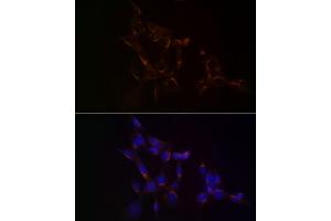 Immunofluorescence analysis of NIH/3T3 cells using USO1 Rabbit mAb (ABIN7271234) at dilution of 1:100 (40x lens). (USO1 抗体)