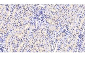 Detection of ANXA3 in Human Kidney Tissue using Polyclonal Antibody to Annexin A3 (ANXA3) (Annexin A3 抗体  (AA 26-160))