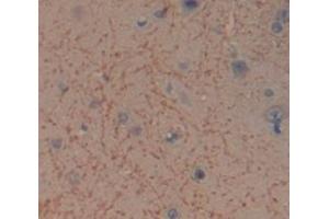 Used in DAB staining on fromalin fixed paraffin- embedded Kidney tissue (ITSN1 抗体  (AA 1-227))