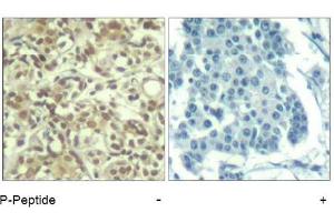 Image no. 1 for anti-V-Akt Murine Thymoma Viral Oncogene Homolog 1 (AKT1) (pThr450) antibody (ABIN319272) (AKT1 抗体  (pThr450))