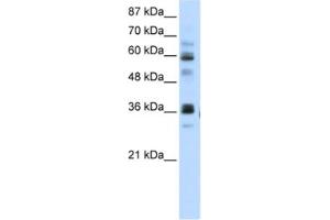Western Blotting (WB) image for anti-RNA Pseudouridylate Synthase Domain Containing 2 (RPUSD2) antibody (ABIN2462340) (RPUSD2 抗体)