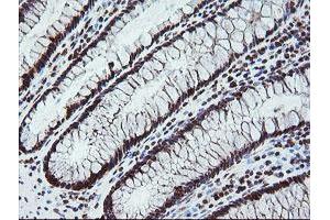 Image no. 9 for anti-Fetal and Adult Testis Expressed 1 (FATE1) antibody (ABIN1498222)