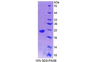 SDS-PAGE analysis of Rat GaA Protein. (GAA 蛋白)