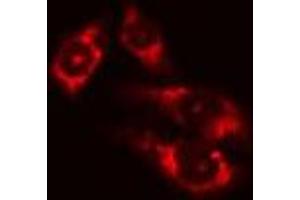 ABIN6275046 staining Hela cells by IF/ICC. (ATG4D 抗体  (C-Term))