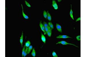 Immunofluorescent analysis of Hela cells using ABIN7159469 at dilution of 1:100 and Alexa Fluor 488-congugated AffiniPure Goat Anti-Rabbit IgG(H+L) (MPPED1 抗体  (AA 1-326))