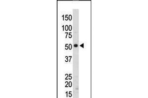 Antibody is used in Western blot to detect SRMS in mouse kidney tissue lysate. (SRMS 抗体  (C-Term))