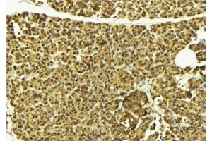 ABIN6269396 at 1/100 staining Mouse pancreas tissue by IHC-P. (HDAC8 抗体  (N-Term))