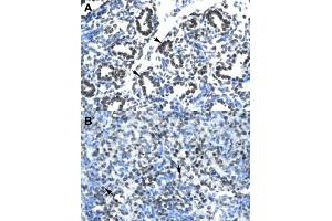 Immunohistochemical staining (Formalin-fixed paraffin-embedded sections) of human lung (A) and human spleen (B) with CLDN17 polyclonal antibody  at 4-8 ug/mL working concentration. (Claudin 17 抗体  (Internal Region))