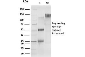 SDS-PAGE Analysis Purified CELF2 Mouse Monoclonal Antibody (PCRP-CELF2-1E4) Confirmation of Purity and Integrity of Antibody. (CELF2 抗体)