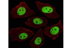 Immunofluorescent analysis of A549 cells using LIN28A antibody at 1:100. (LIN28A 抗体  (AA 108-138))
