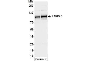 anti-La Ribonucleoprotein Domain Family, Member 4B (LARP4B) (AA 600-650) antibody