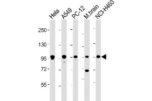 Western Blot at 1:2000 dilution Lane 1: Hela whole cell lysate Lane 2: A549 whole cell lysate Lane 3: PC-12 whole cell lysate Lane 4: mouse brain lysate Lane 5: NCI-H460 whole cell lysate Lysates/proteins at 20 ug per lane. (PCSK1 抗体  (AA 682-715))