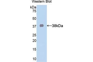 Western blot analysis of the recombinant protein. (Lactate Dehydrogenase A 抗体  (AA 1-332))