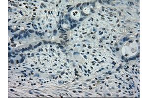 Image no. 3 for anti-Signal Transducer and Activator of Transcription 1, 91kDa (STAT1) antibody (ABIN1501168) (STAT1 抗体)