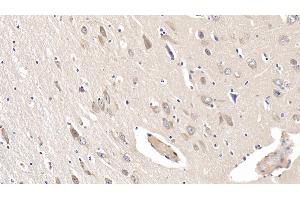 Detection of IL19 in Human Cerebrum Tissue using Monoclonal Antibody to Interleukin 19 (IL19) (IL-19 抗体  (AA 25-177))