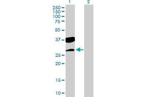Western Blot analysis of CTDSP2 expression in transfected 293T cell line by CTDSP2 MaxPab polyclonal antibody. (CTDSP2 抗体  (AA 1-271))