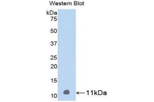 Western Blotting (WB) image for anti-Parathyroid Hormone (PTH) (AA 31-115) antibody (ABIN1078421) (PTH 抗体  (AA 31-115))
