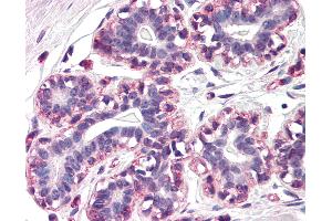 Anti-RAMP3 antibody IHC of human breast. (RAMP3 抗体  (N-Term))