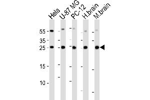 Western blot analysis of lysates from Hela, U-87 MG, rat PC-12 cell line , huamn brain and mouse brain tissue lysate(from left to right), using RAB35 Antibody (C-term) (ABIN6244138 and ABIN6577420). (RAB35 抗体  (C-Term))