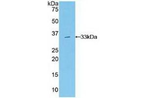 Detection of Recombinant Grb7, Human using Polyclonal Antibody to Growth Factor Receptor Bound Protein 7 (Grb7) (GRB7 抗体  (AA 66-327))