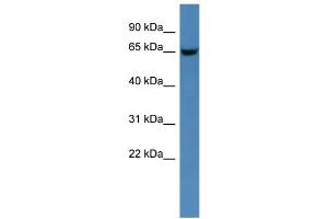 WB Suggested Anti-Gns Antibody Titration: 0. (GNS 抗体  (C-Term))