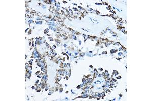 Immunohistochemistry (IHC) image for anti-ATP Synthase, H+ Transporting, Mitochondrial F1 Complex, O Subunit (ATP5O) (AA 24-213) antibody (ABIN6137338)