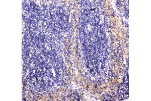 IHC analysis of RAB27A using anti-RAB27A antibody .