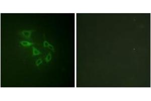 Immunofluorescence analysis of HeLa cells, using PIP5K (Phospho-Ser307) Antibody. (PIKFYVE 抗体  (pSer307))