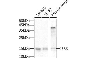 Western blot analysis of extracts of various cell lines, using IER3 antibody (ABIN6134174, ABIN6142158, ABIN6142159 and ABIN6224665) at 1:500 dilution. (IER3 抗体  (C-Term))