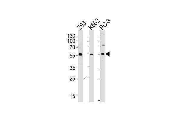PIP5KL1 Antikörper  (N-Term)