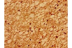 Immunohistochemistry of paraffin-embedded human brain tissue using ABIN7168566 at dilution of 1:100 (Sacsin 抗体  (AA 983-1150))