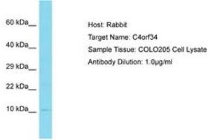 Image no. 1 for anti-Small Integral Membrane Protein 14 (SMIM14) (AA 12-61) antibody (ABIN6750772) (SMIM14 抗体  (AA 12-61))