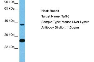 Western Blotting (WB) image for anti-TAF10 RNA Polymerase II, TATA Box Binding Protein (TBP)-Associated Factor, 30kDa (TAF10) (C-Term) antibody (ABIN2777290)