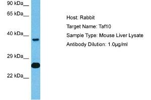 Host: Mouse Target Name: TAF10 Sample Tissue: Mouse Liver Antibody Dilution: 1ug/ml (TAF10 抗体  (C-Term))