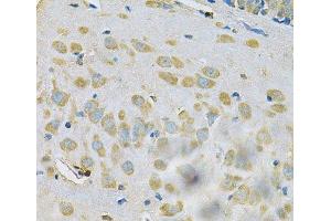 Immunohistochemistry of paraffin-embedded Rat brain using SAR1A Polyclonal Antibody at dilution of 1:100 (40x lens). (SAR1A 抗体)