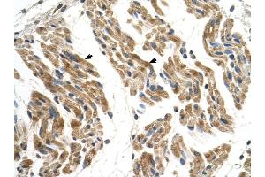 SLC35F2 antibody was used for immunohistochemistry at a concentration of 4-8 ug/ml to stain Skeletal muscle cells (arrows) in Human Muscle. (SLC35F2 抗体  (N-Term))