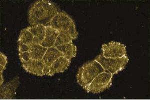 Immunofluorescence staining of A431 cells (Human epithelial carcinoma, ATCC CRL-1555). (FKBP10 抗体  (AA 434-576))